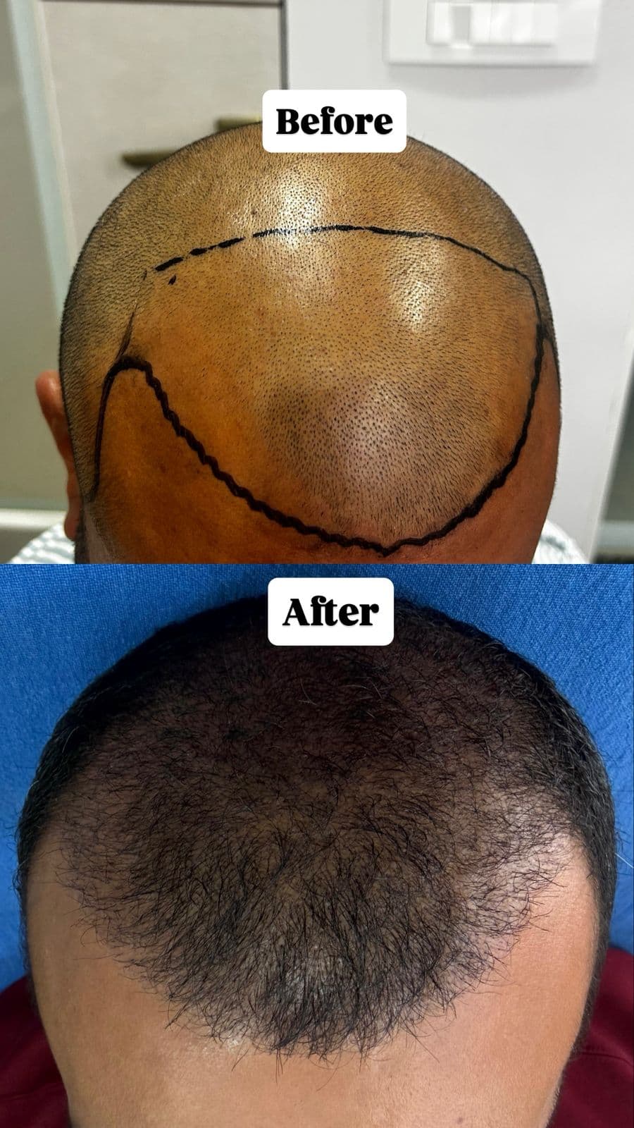 Hair Result